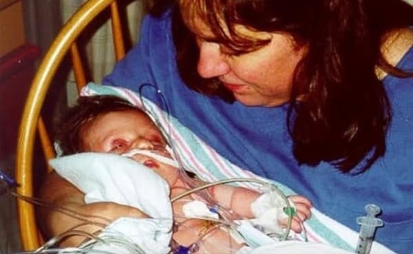 “Helplessly watching your child experience pain changes you at a basic level,” says writer Troy Maynard. When his daughter wa